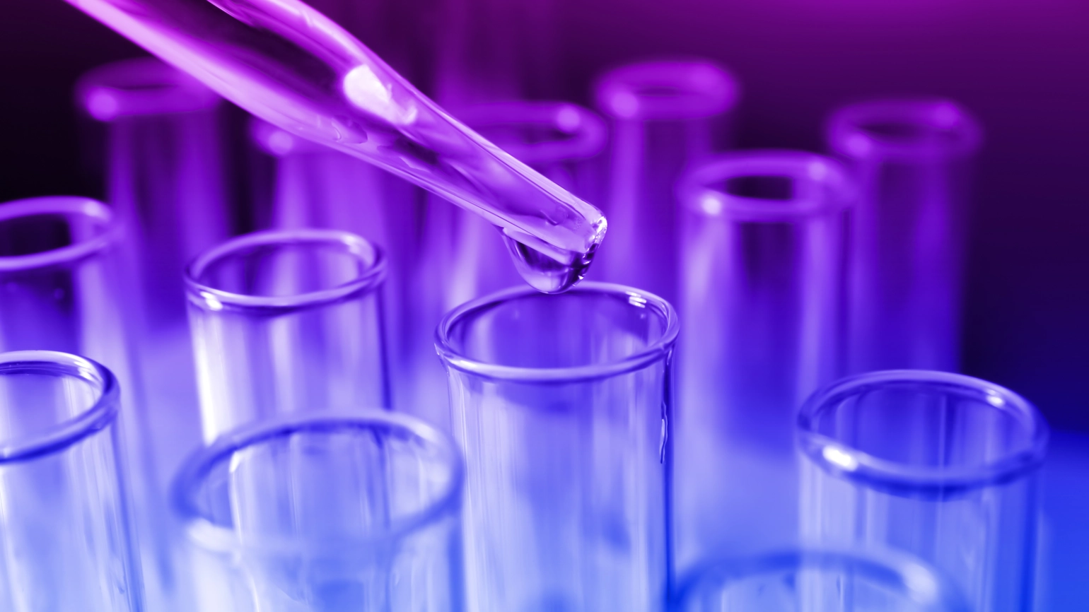 test tubes in a healthcare services lab test tubes in a healthcare services lab