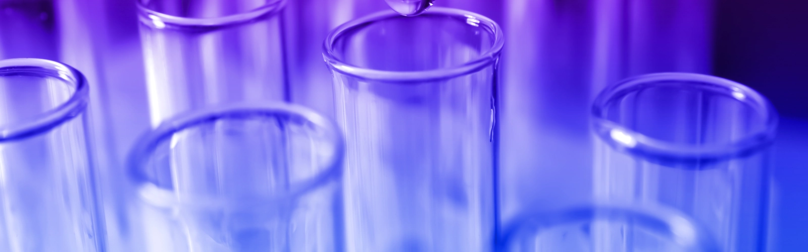 test tubes in a healthcare services lab test tubes in a healthcare services lab